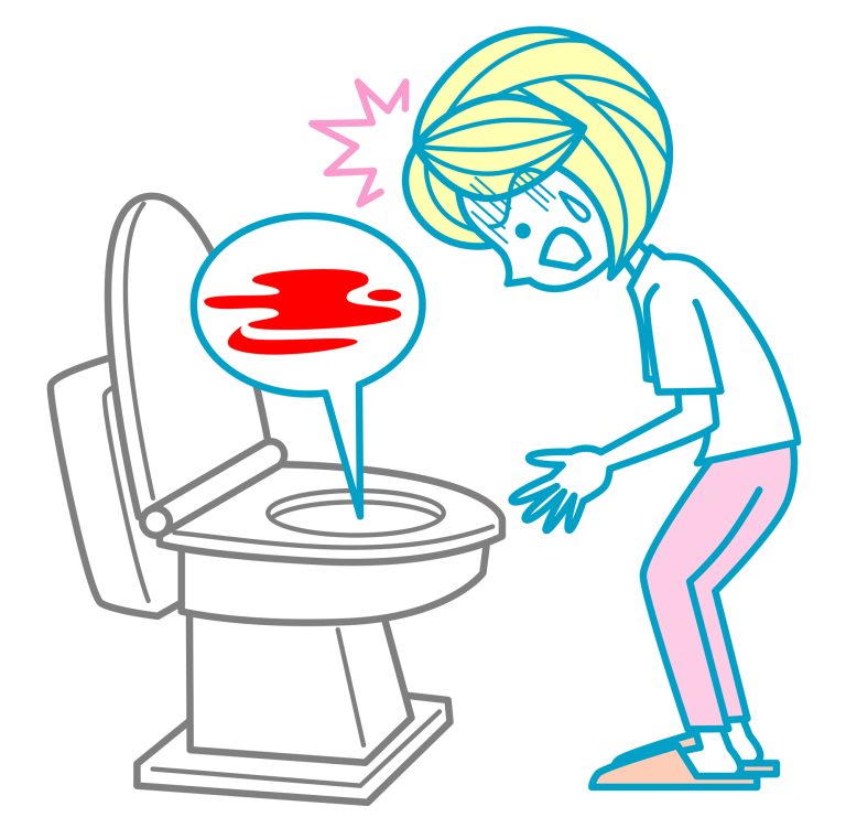 血便が一回だけでも病院に行った方がいいの？