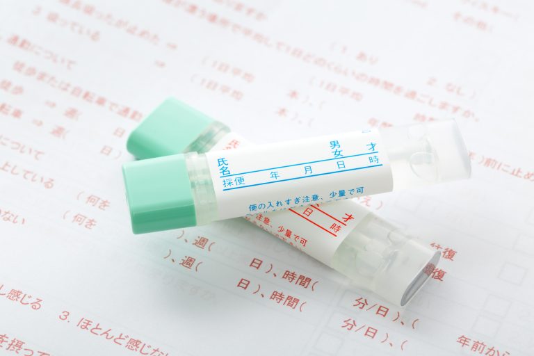 便潜血検査とは？